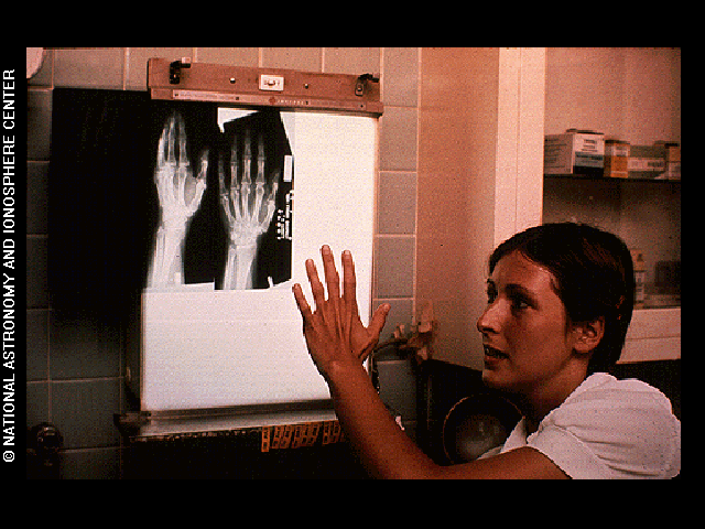 X-ray of hand